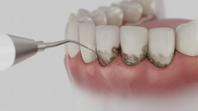 Reliable Emergency Dentist contractor in Downey, CA by Smile Center Dentistry
